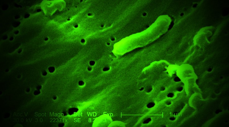 Image of cholera causing bacteria Vibrio cholerae